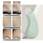 Blackhead Removal Facial Cleansing Tool