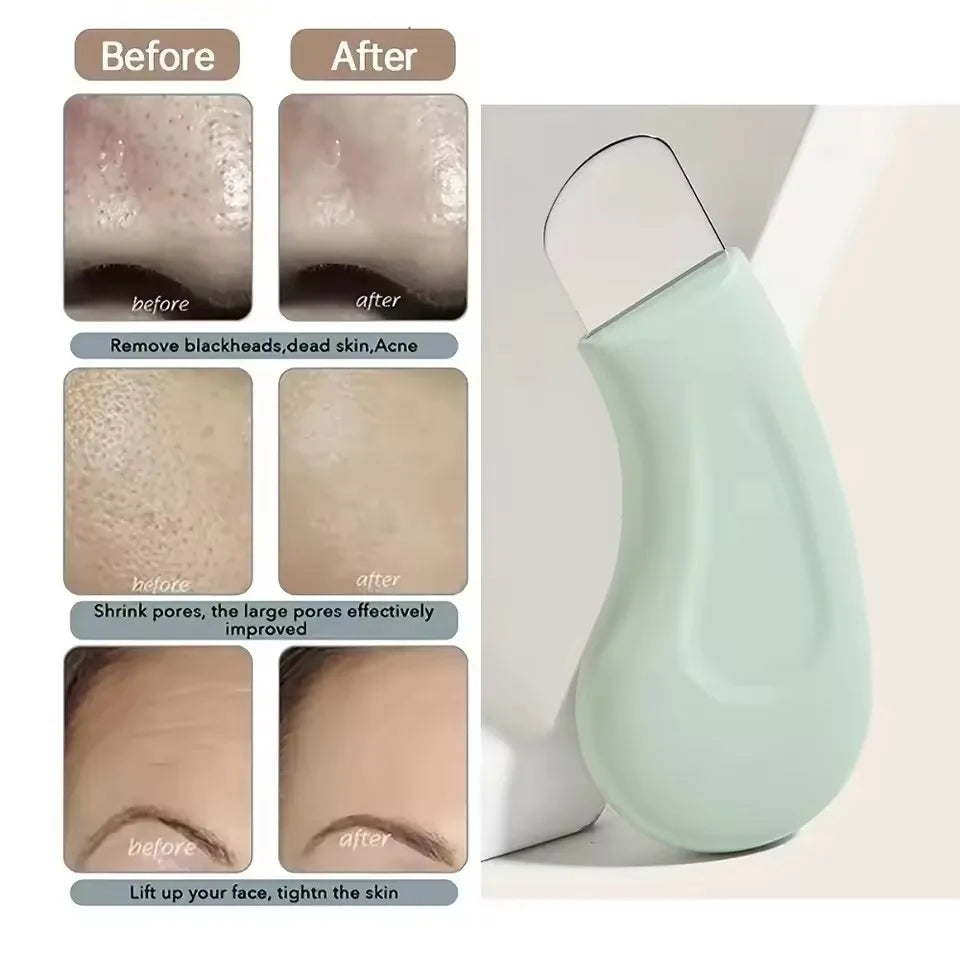 Blackhead Removal Facial Cleansing Tool