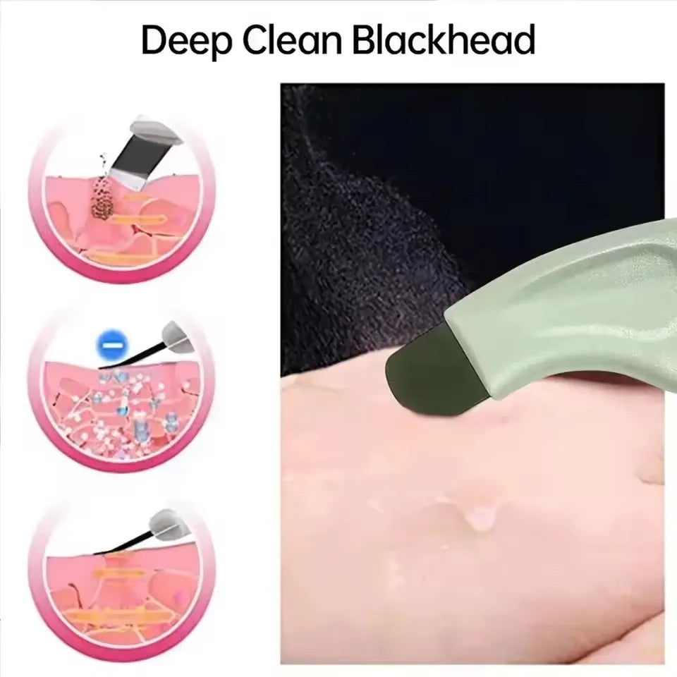 Blackhead Removal Facial Cleansing Tool